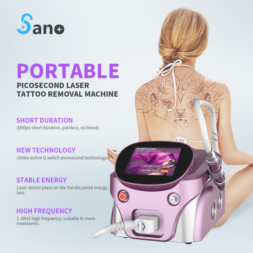 pico laser tatuoinnin poistokone